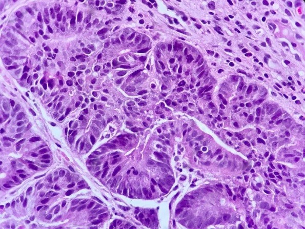 Patología digestiva