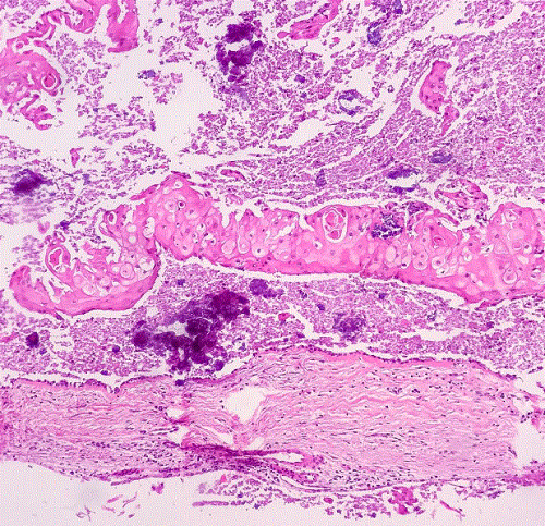 Patología de Cabeza y Cuello